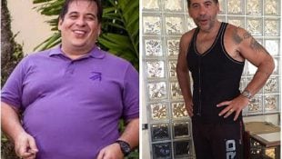 Veja antes e depois de 6 famosos que fizeram cirurgia para emagrecer