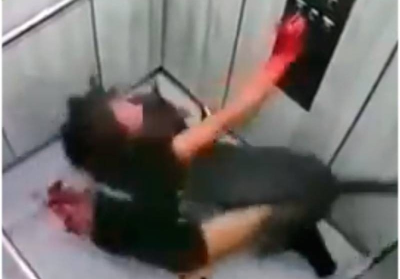Vídeo: em ataque brutal, pit-bull fica pendurado em lábio de