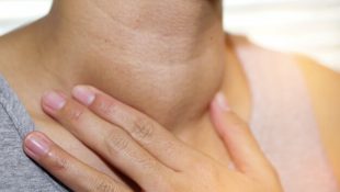 6 sintomas silenciosos de câncer de tireoide para ficar de olho