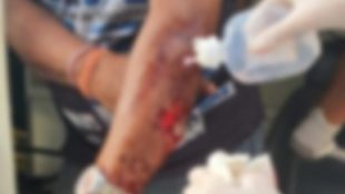 Briga entre pedintes no semáforo em Anápolis termina com sangue e ambulância