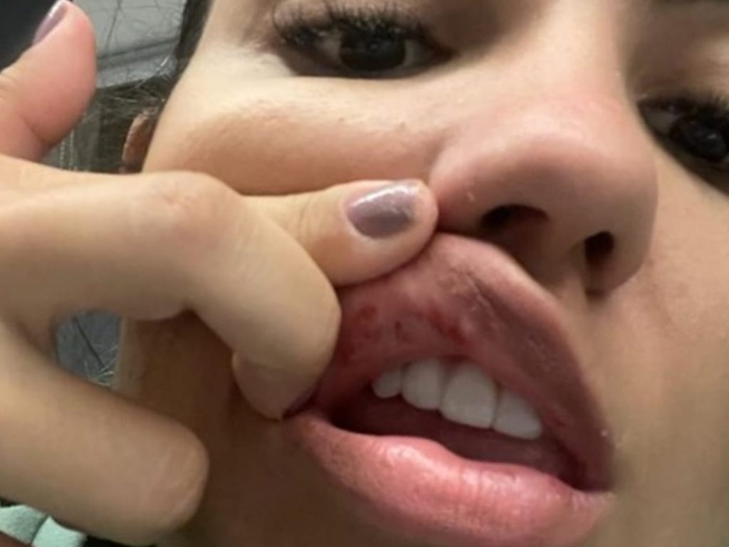 Dentista goiana denuncia ter sido agredida por empresário e recebe apoio de famosos