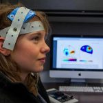 Estimulação Transcraniana