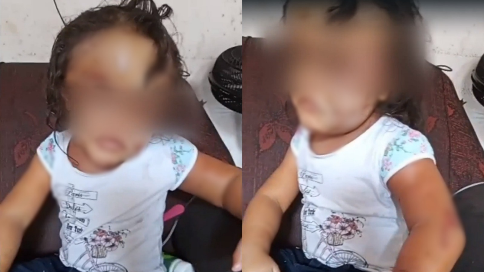 Criança que teve rosto desfigurado após ser agredida pela mãe e a madrasta recebe alta, em Goiânia