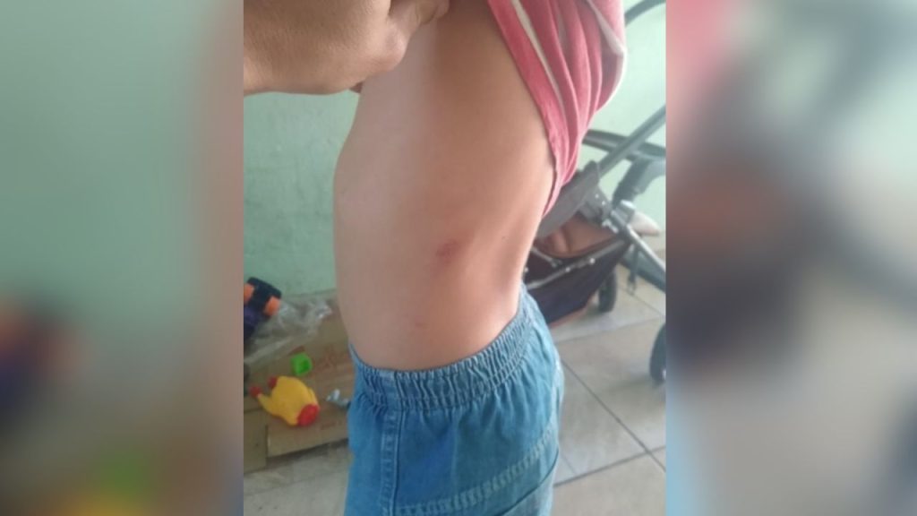 Costela extra? Um traço raro que você talvez nem note no seu corpo