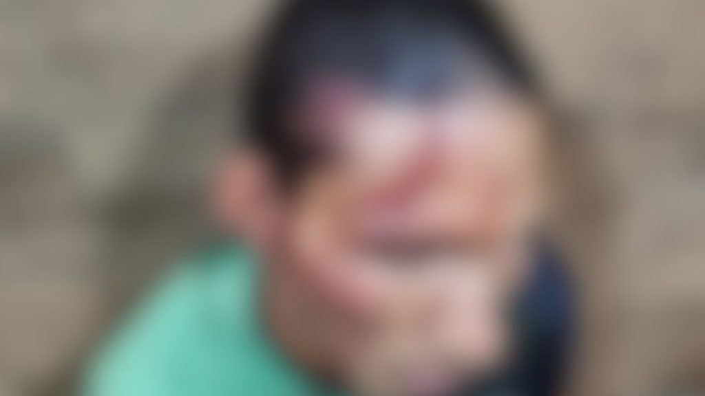 Vítima corte cabeça