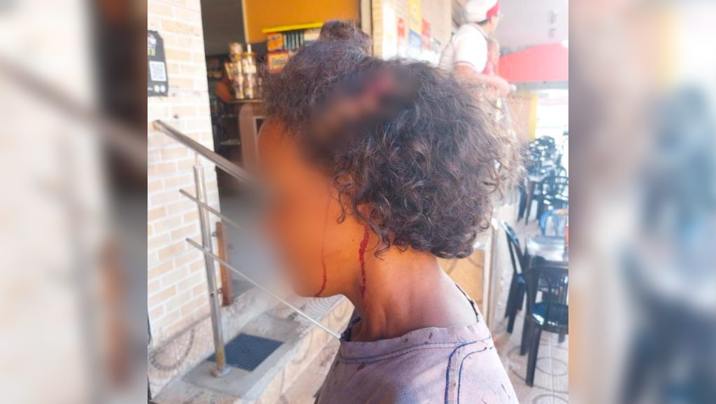 Mulher é esfaqueada ao tentar usar banheiro em padaria.