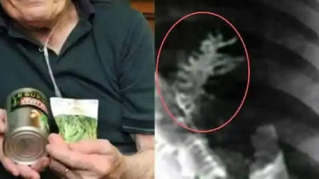 Planta de ervilha encontrada dentro do corpo humano