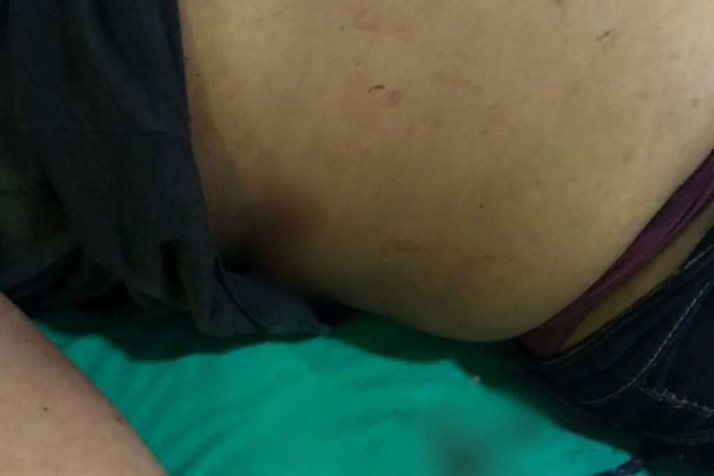 Grávida é esfaqueada na barriga após impedir que mulher beijasse namorado em forró de Anápolis