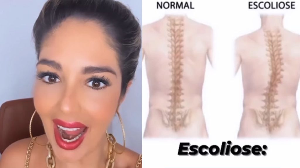 Quem tem problema na coluna pode pedir ao INSS para se aposentar