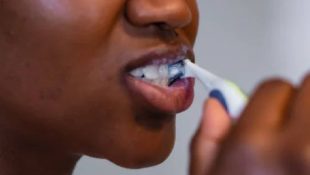 Dentes sujos podem ser um sinal de mau hálito
