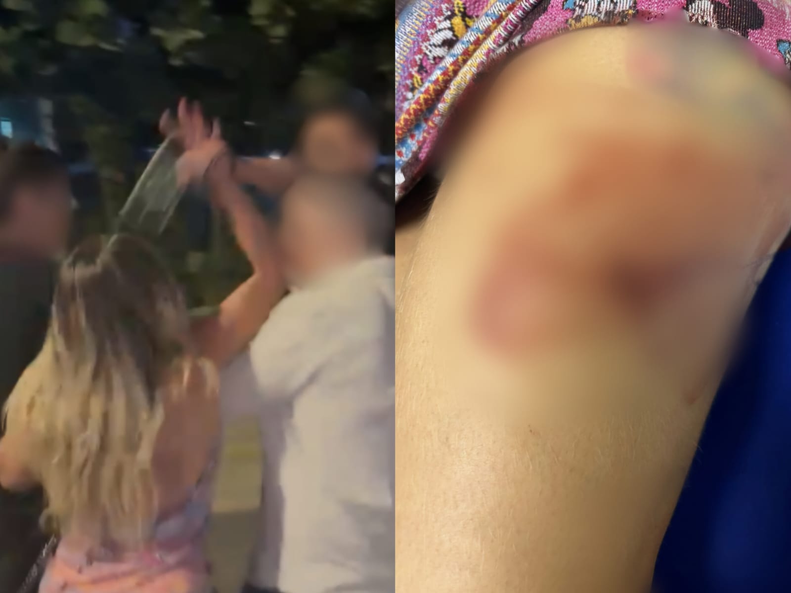 Suspeito teria ficado agressivo após a rejeição. (Foto: Reprodução)