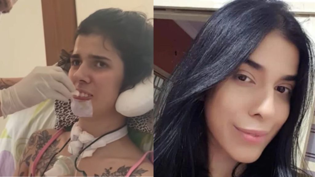 Thaís Medeiros tem melhora no quadro.