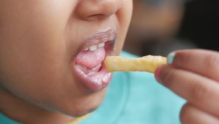Paladar de ouro: pessoas que sentem sabores que passam despercebidos para a maioria