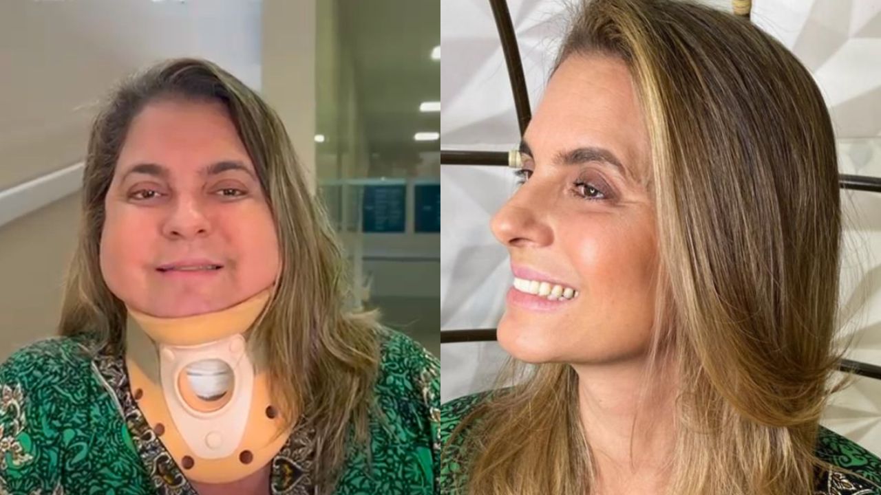 Com tumor de 4 cm na coluna, goianiense precisa de cirurgia e luta para arrecadar R$ 200 mil