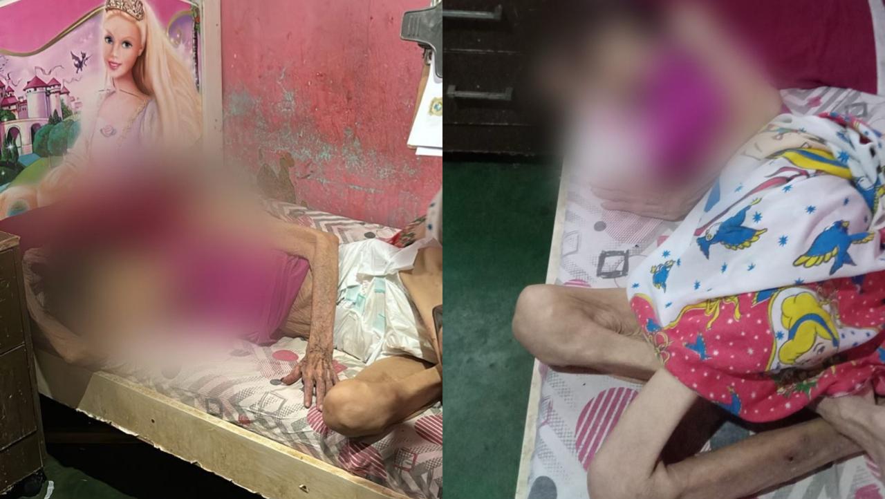 Abandono e maus-tratos: polícia prende filho que deixou mãe idosa em situação desumana em Goiânia