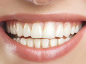 Cientistas criam tecnologia inédita para reparar o esmalte dental
