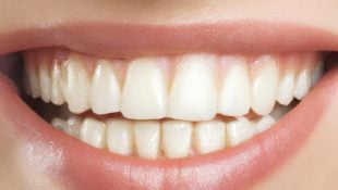 O motivo por trás do famoso “dar com a língua nos dentes”