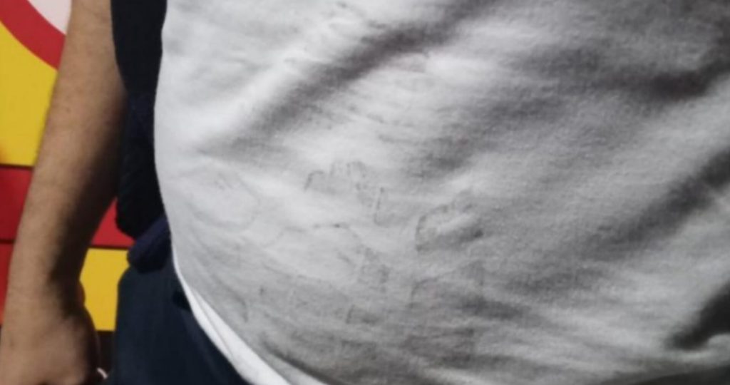 Camiseta do cliente ficou com marcas das agressões. (Foto: Reprodução)