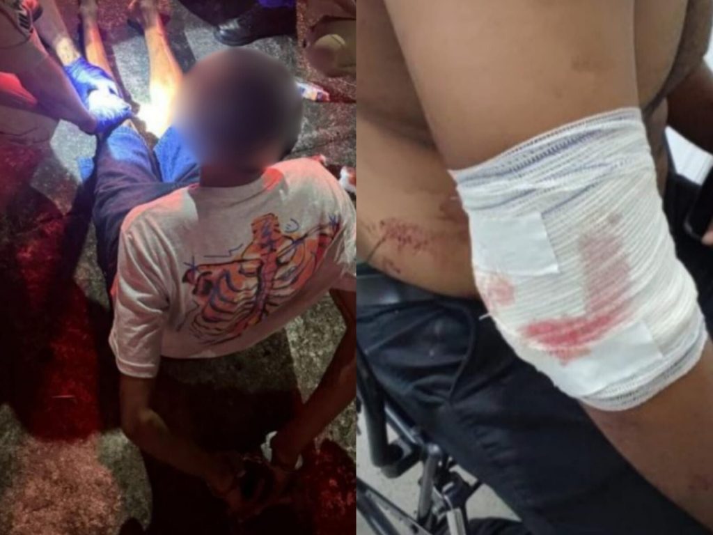 Segurança do local também foi esfaqueado. (Foto: Reprodução)