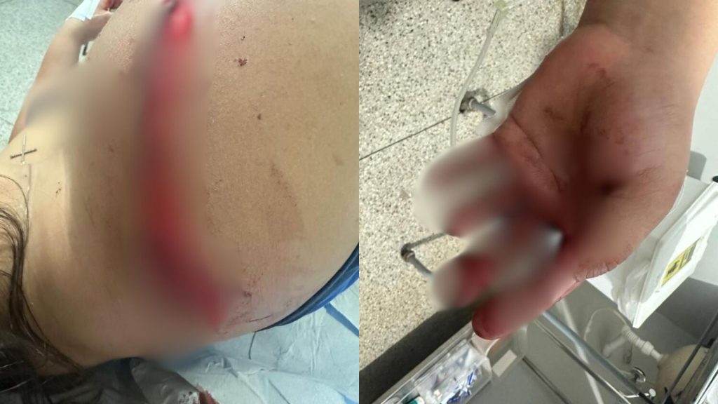 A vítima tentou se defender mas sofreu ferimentos graves (Foto: Reprodução)