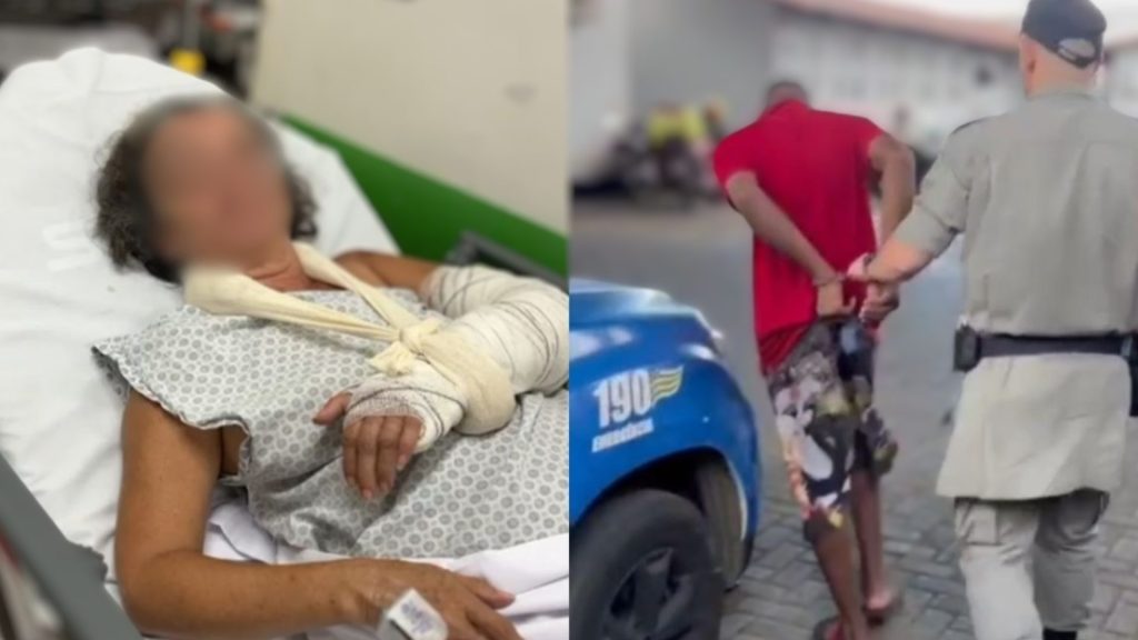 Idosa tem fratura exposta após Assalto