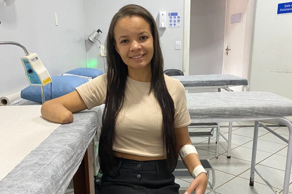 Railma teve a mão decepada após ser atacada pelo ex. (Foto: Arquivo Pessoal) prótese