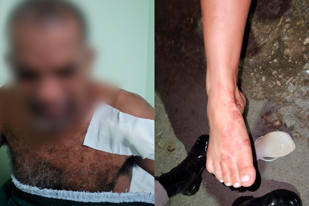 Noitada termina em garrafada, pé quebrado e polícia, após discussão por valor de conta