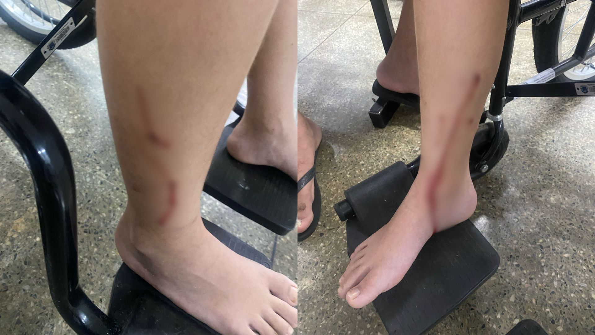 Cachorro violento vira caso de polícia em Anápolis após crianças serem atacadas no meio da rua