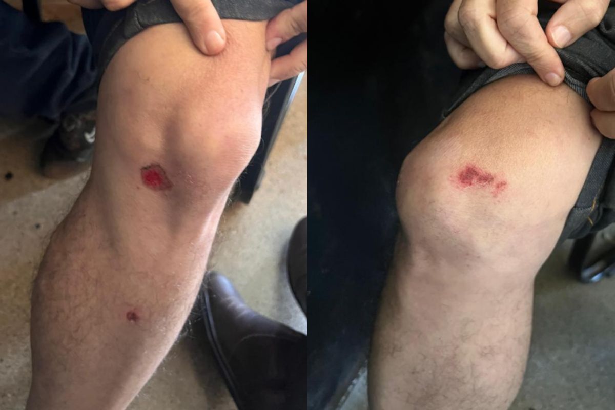 Jornalista é agredido com socos e tapas por servidor público em Santo Antônio do Descoberto