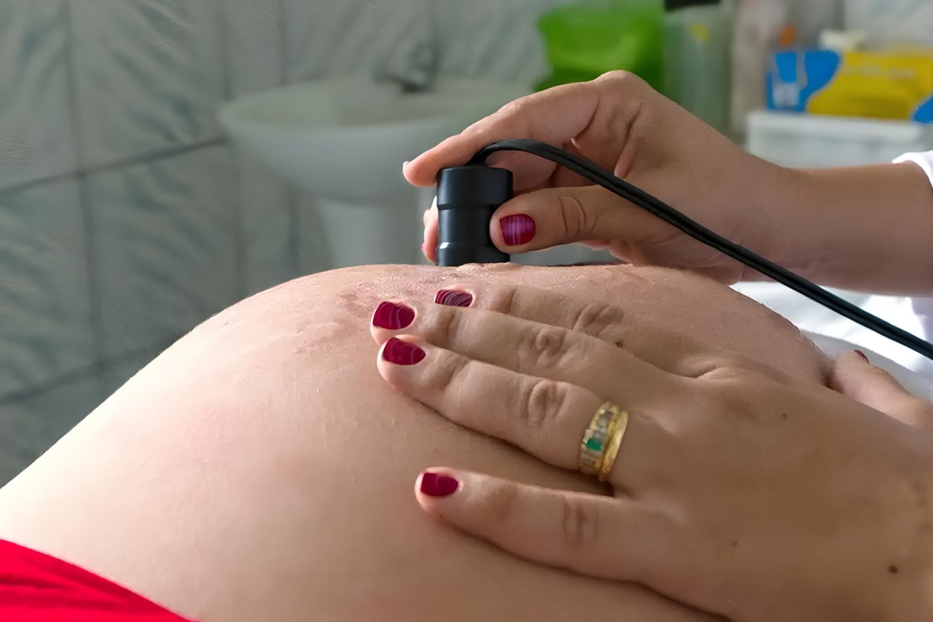 Médico de Goiânia explica possíveis causas para perda de bebê no fim da gestação