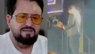 Com 15 pontos e costelas trincadas, Marrone detalha queda de 3 m do palco