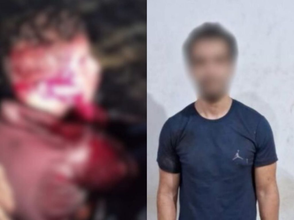 Vítima foi encaminhada ao Hugo com diversas facadas pelo corpo. (Foto: Reprodução)