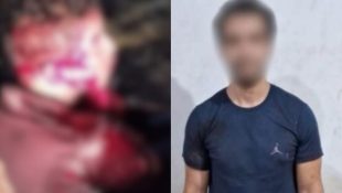 Vítima foi encaminhada ao Hugo com diversas facadas pelo corpo. (Foto: Reprodução)