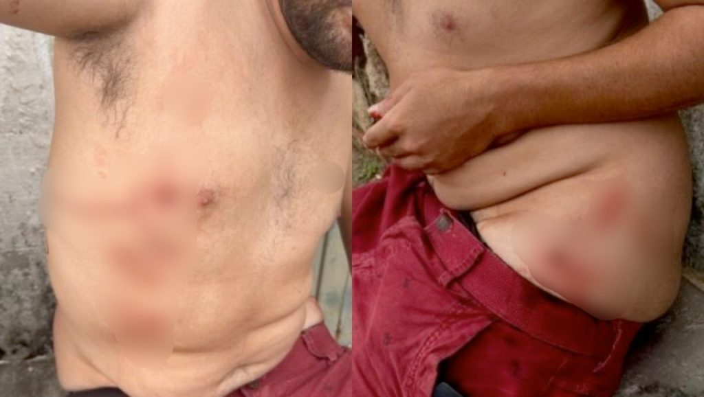 Briga entre vizinhos em Anápolis termina em homem esfaqueado por idoso de 88 anos