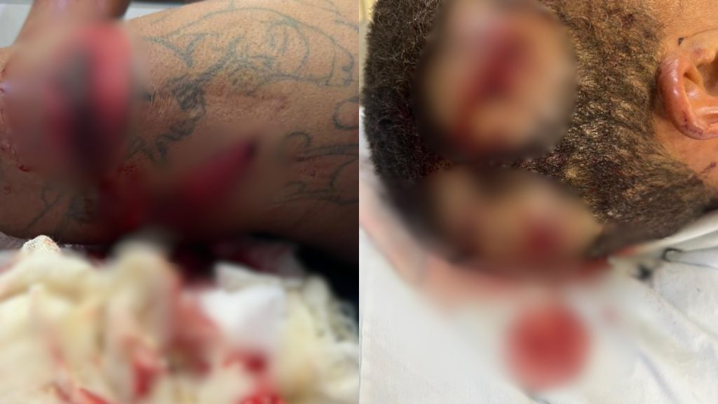 Jovem aproveita mãe dormindo e 'navalha' corpo da ex em diversas partes