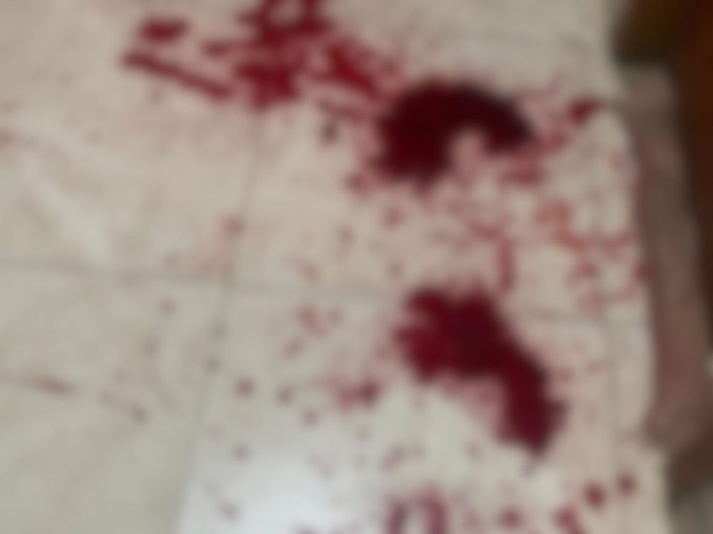 Vítima estava completamente ensanguentada. (Foto: Reprodução)