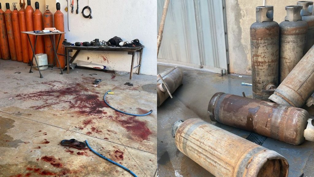 Homem teve a perna amputada após a explosão. (Foto: Reprodução)