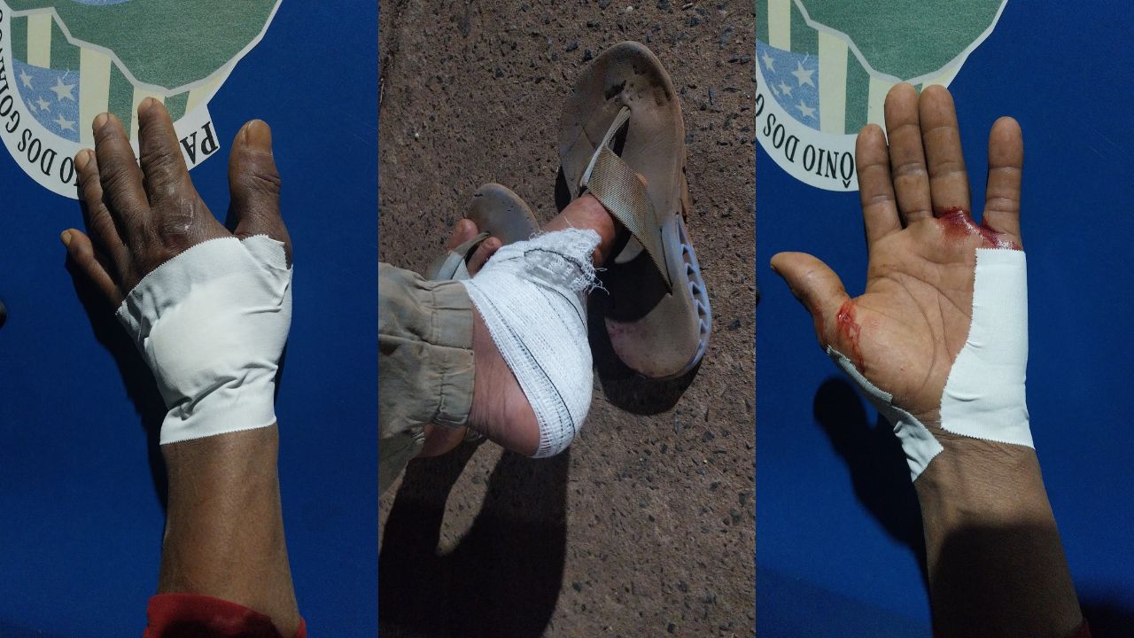 Homem foi baleado em Aparecida de Goiânia. (Foto: Divulgação/PM)