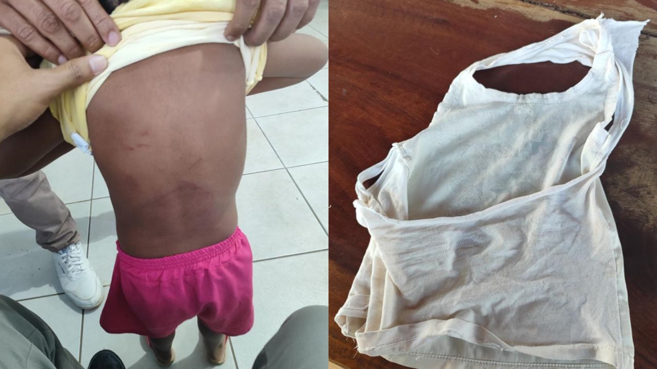 Padrasto ainda teria agredido a enteada menor. (Foto: Reprodução)