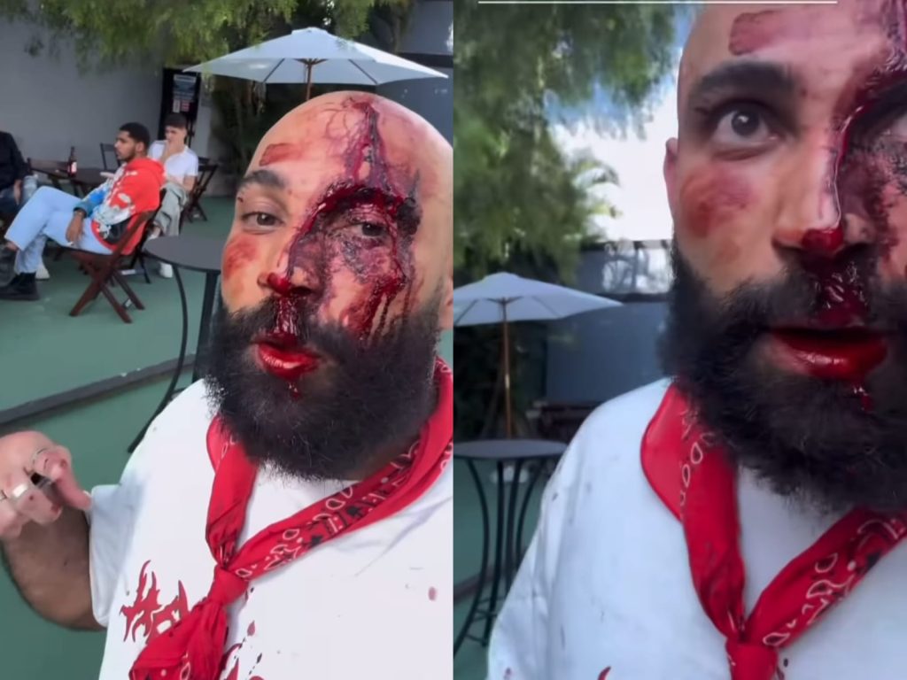 Wilker gravou um vídeo denunciado a situação. (Foto: Redes Sociais)