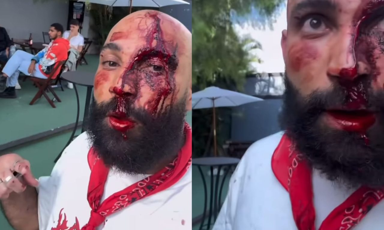 Wilker gravou um vídeo denunciado a situação. (Foto: Redes Sociais)