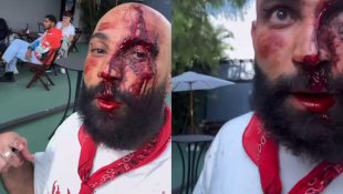 Wilker gravou um vídeo denunciado a situação. (Foto: Redes Sociais)