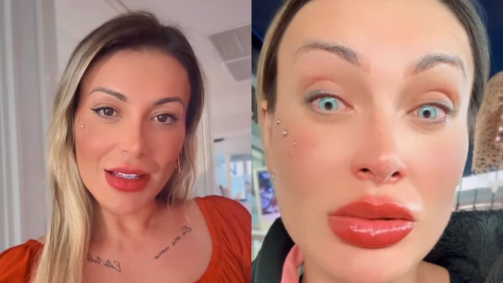 Andressa Urach fez cirurgia para mudar a cor dos olhos.