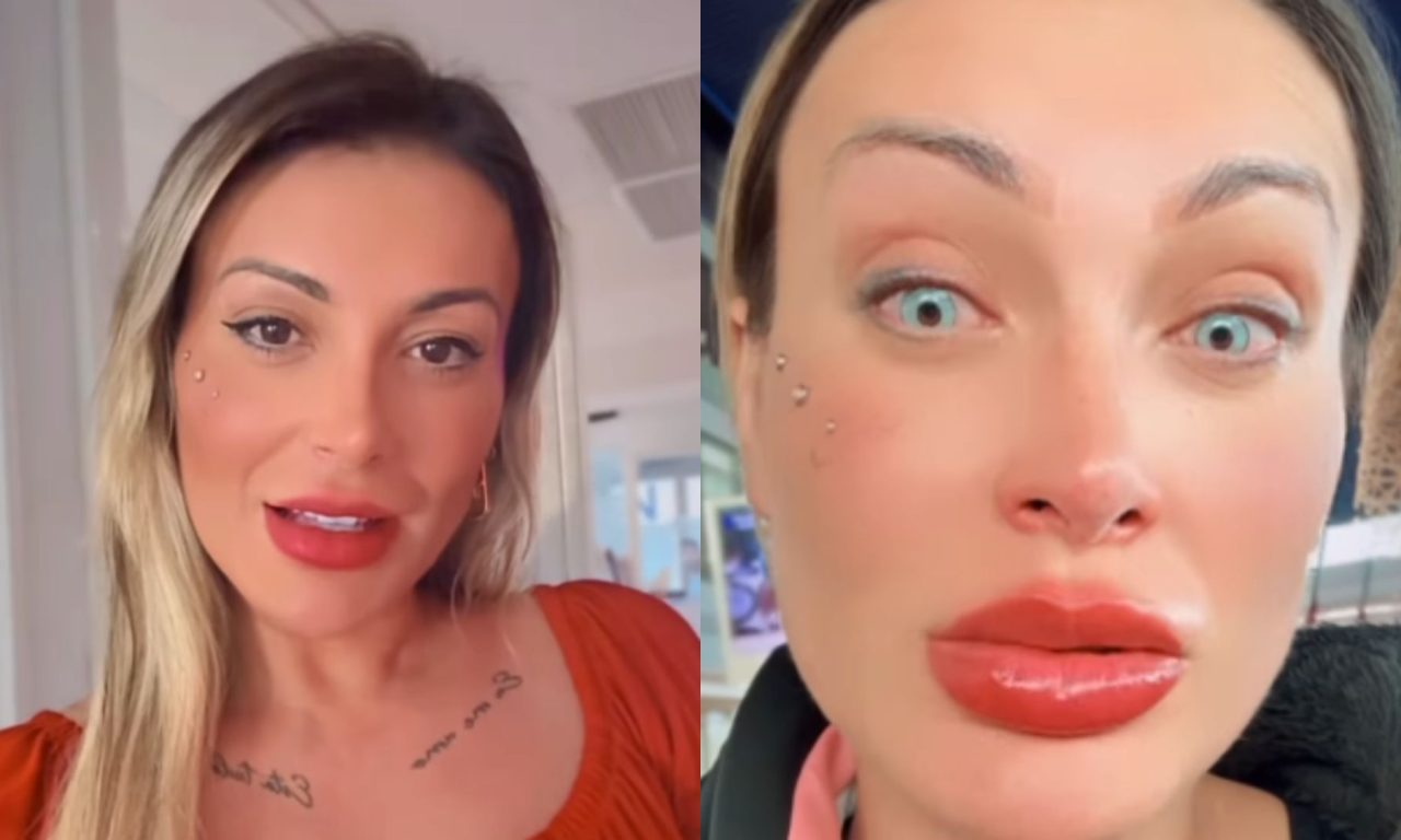 Andressa Urach fez cirurgia para mudar a cor dos olhos.