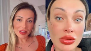 Andressa Urach fez cirurgia para mudar a cor dos olhos.