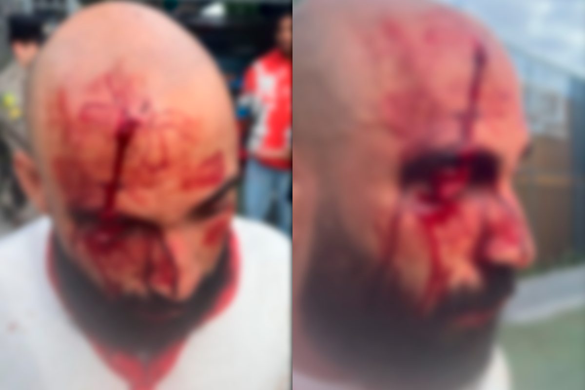 Segurança leva cantada em boate de Goiânia, pai chega na hora e agride frequentador