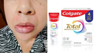 Anvisa proíbe pasta de dente da Colgate denunciada por mais de 1 mil pessoas de todo o país