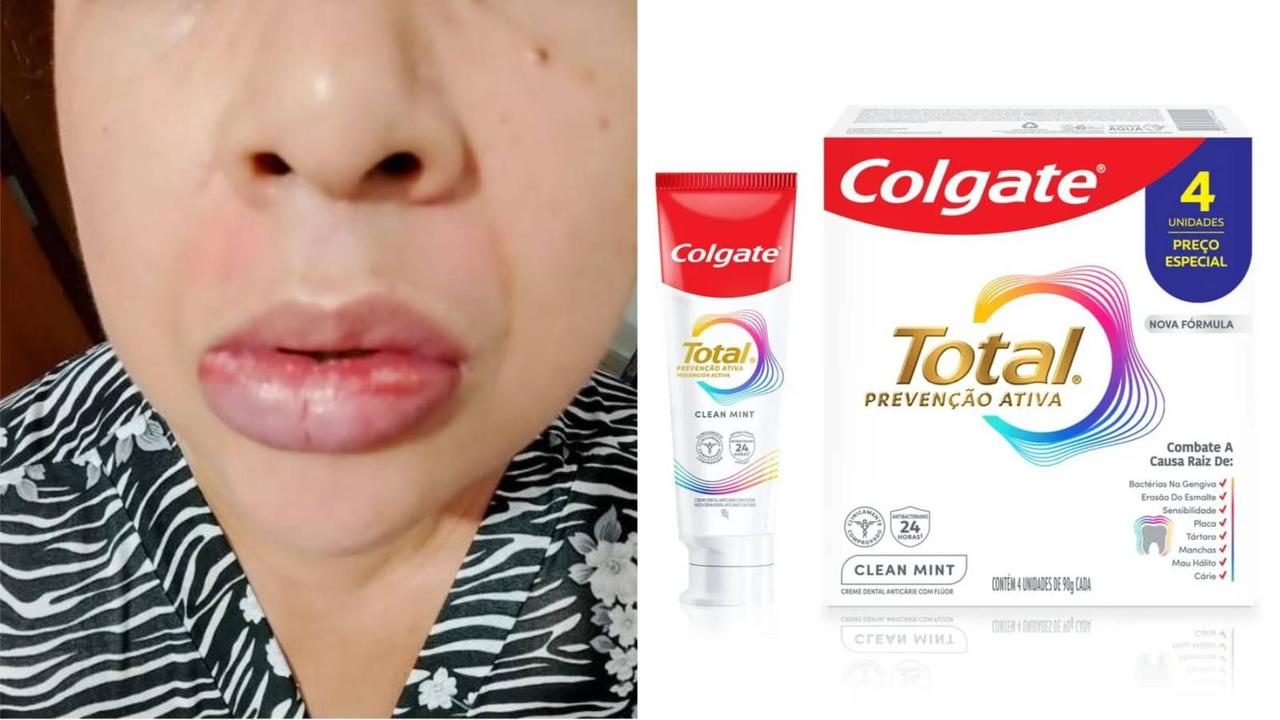 Anvisa proíbe pasta de dente da Colgate denunciada por mais de 1 mil pessoas de todo o país