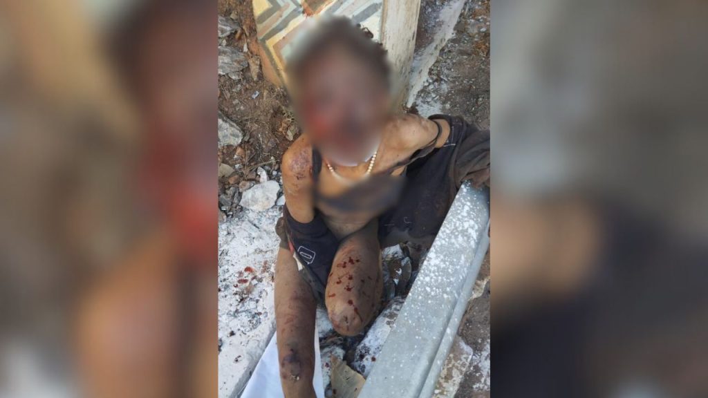 Morador em situação de rua teria atacado a vítima. (Foto: Reprodução)