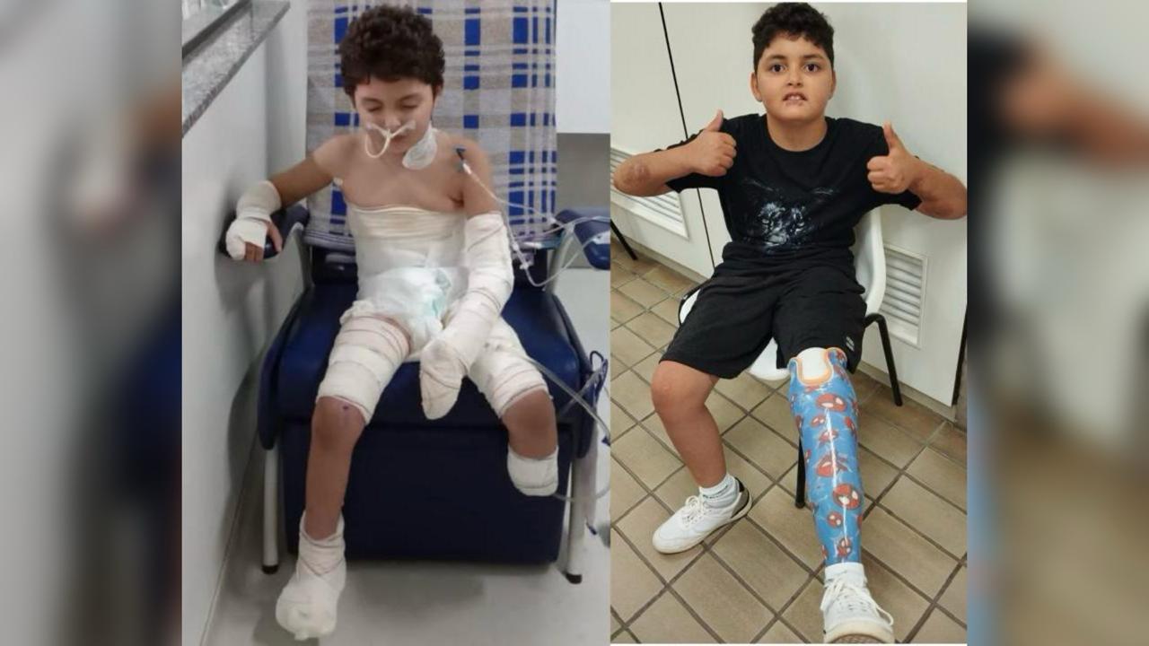 Mãe faz rifa para adaptar casa em Anápolis e garantir autonomia a filho que sobreviveu a choque